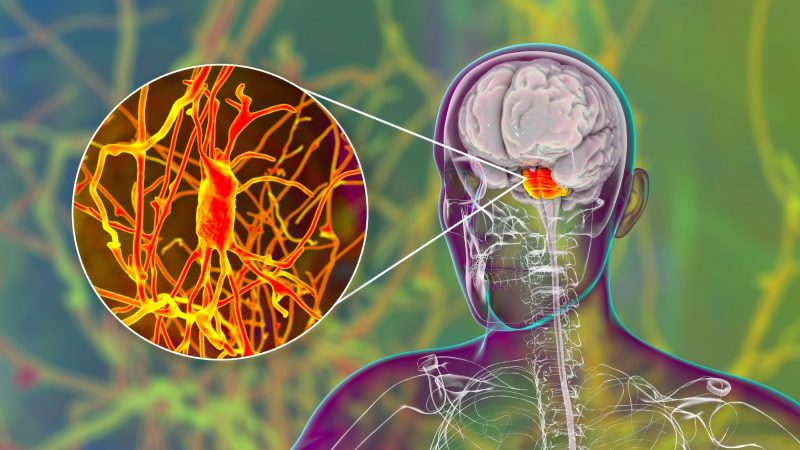 न्यूरोसर्जन और न्यूरोलॉजिस्ट का अंतर समझना है जरूरी