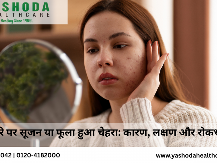 चेहरे पर सूजन या फूला हुआ चेहरा कारण, लक्षण और रोकथाम