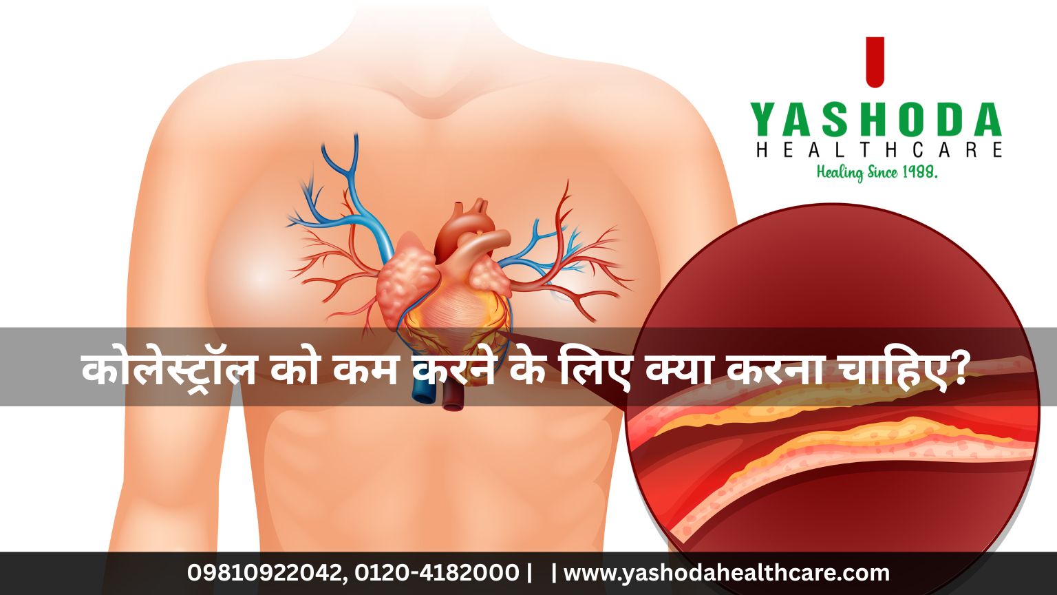 कोलेस्ट्रॉल को कम करने के लिए क्या करना चाहिए?