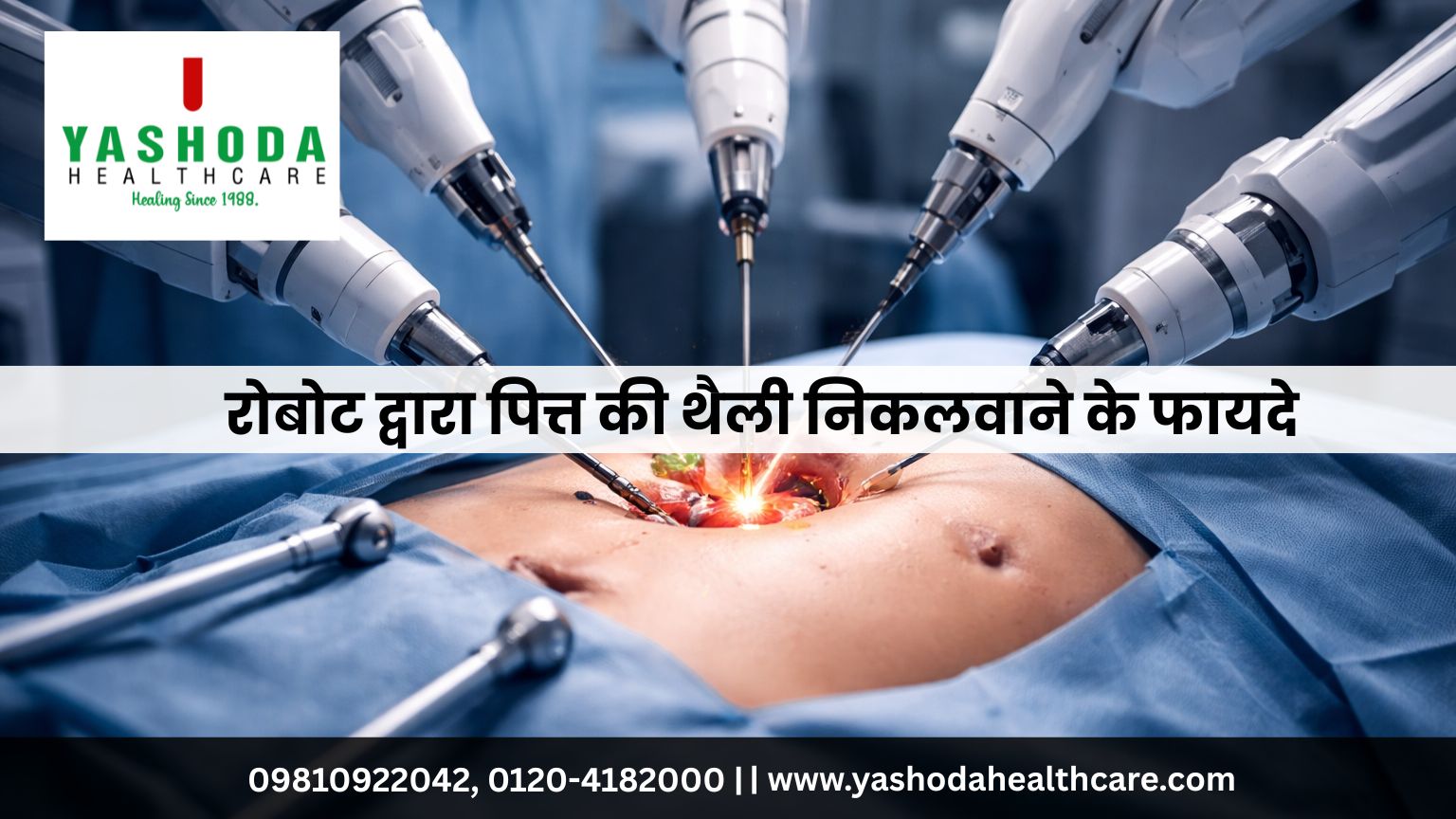 रोबोट द्वारा पित्त की थैली निकलवाने के फायदे