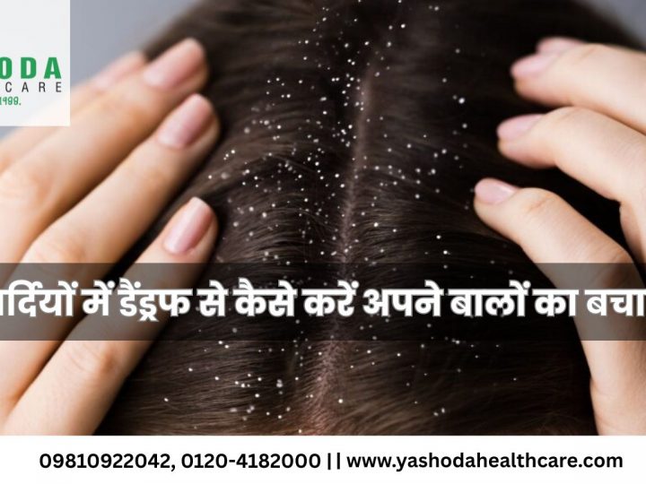सर्दियों में डैंड्रफ से कैसे करें अपने बालों का बचाव