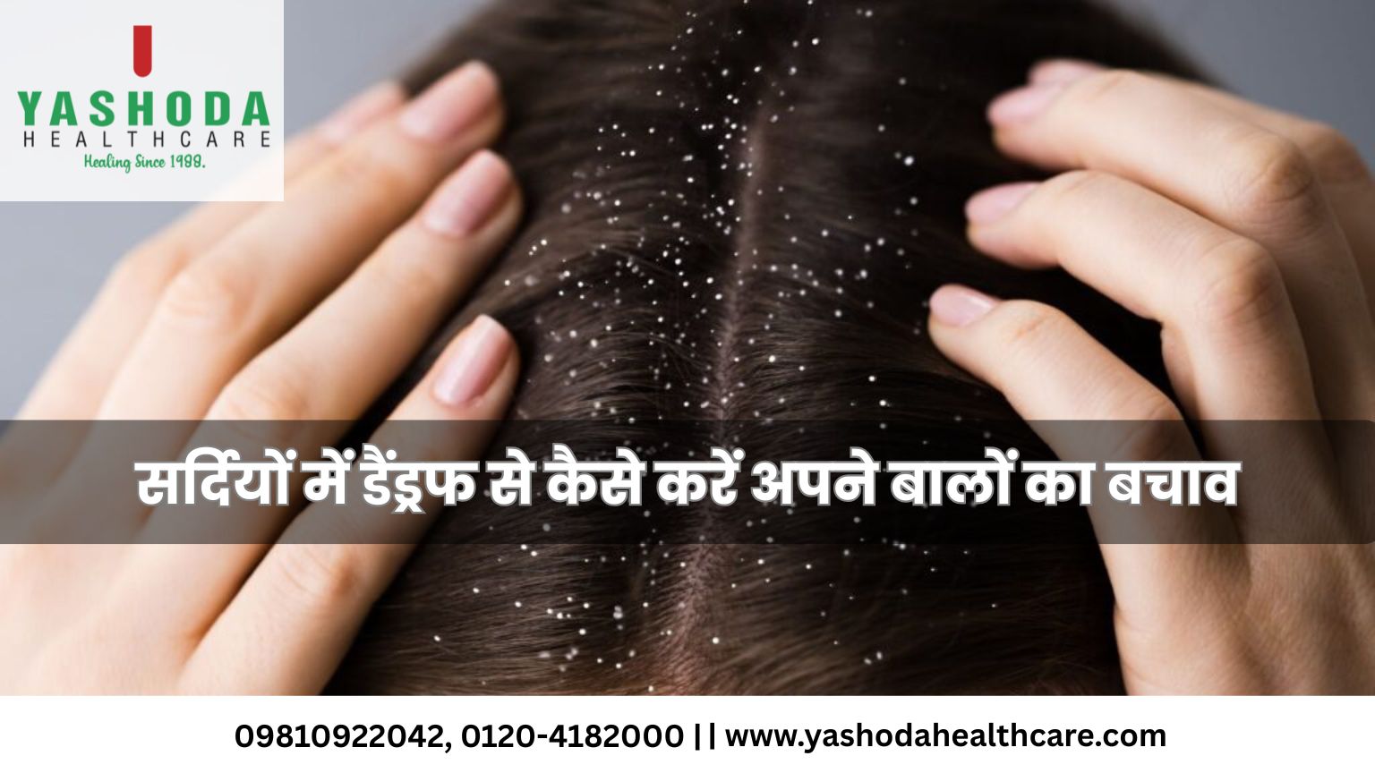 सर्दियों में डैंड्रफ से कैसे करें अपने बालों का बचाव