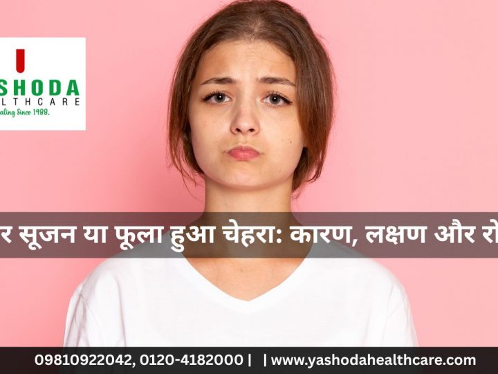 चेहरे पर सूजन या फूला हुआ चेहरा: कारण, लक्षण और रोकथाम