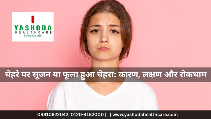 चेहरे पर सूजन या फूला हुआ चेहरा: कारण, लक्षण और रोकथाम