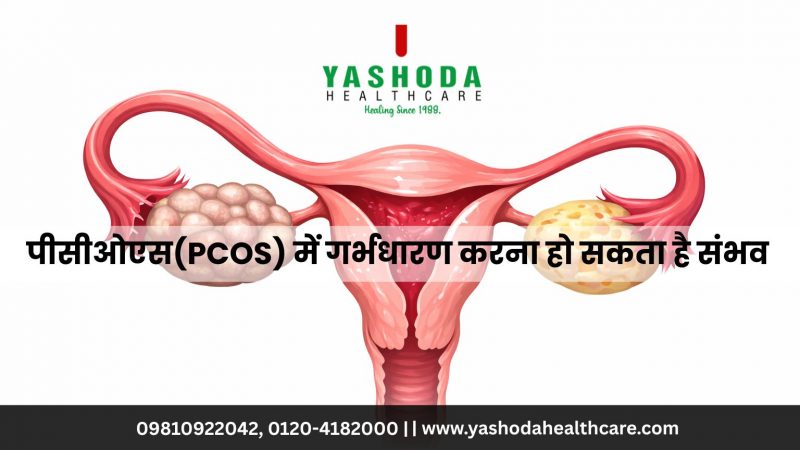 पीसीओएस(PCOS) में गर्भधारण करना हो सकता है संभव