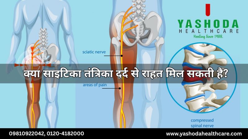 क्या साइटिका तंत्रिका दर्द से राहत मिल सकती है