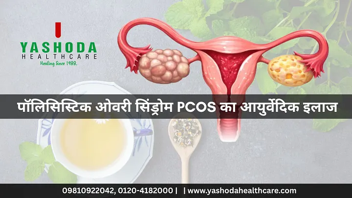पॉलिसिस्टिक ओवरी सिंड्रोम PCOS का आयुर्वेदिक इलाज