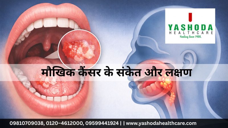 मौखिक कैंसर के संकेत और लक्षण