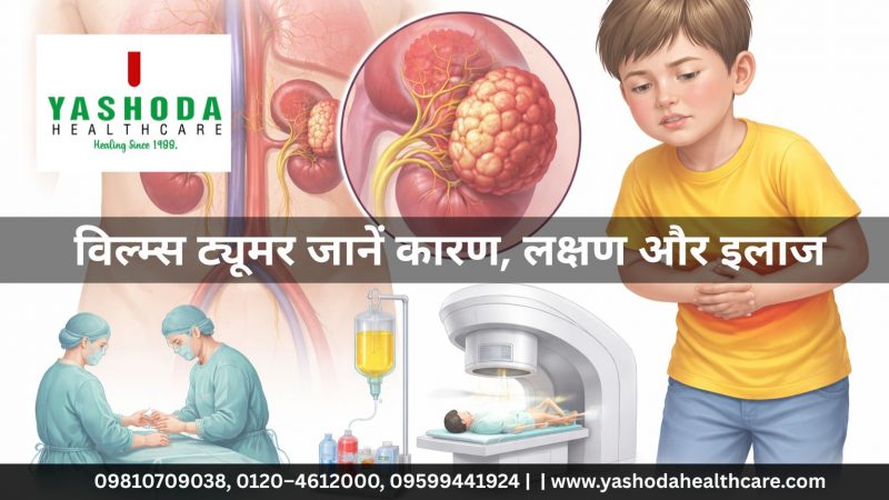 विल्म्स ट्यूमर जानें कारण, लक्षण और इलाज