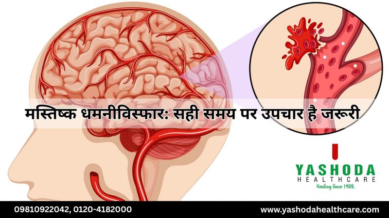मस्तिष्क धमनीविस्फार सही समय पर उपचार है जरूरी