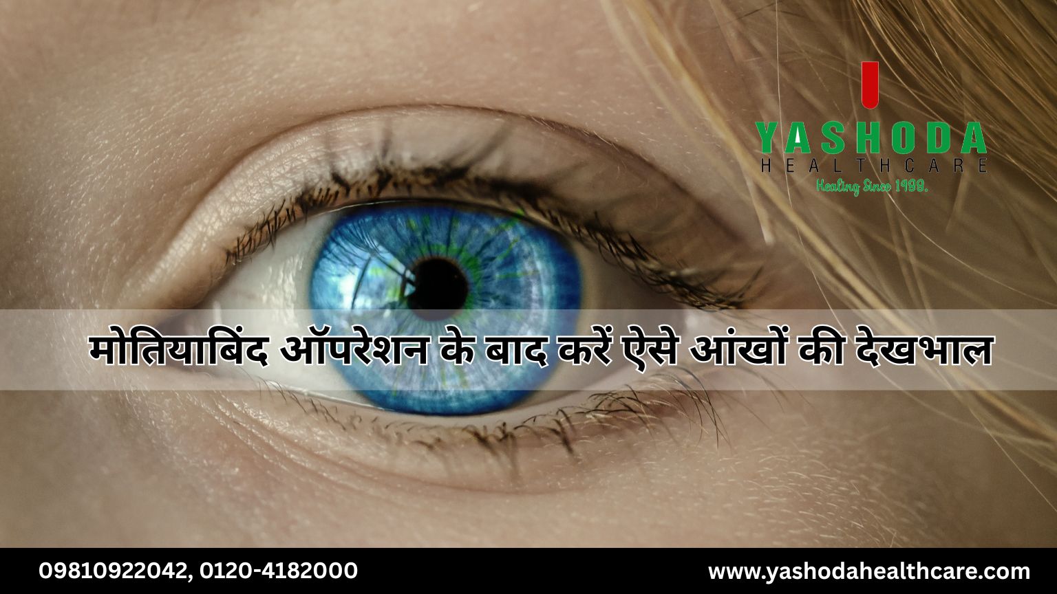 मोतियाबिंद ऑपरेशन के बाद करें ऐसे आंखों की देखभाल