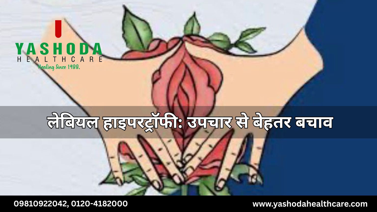 लेबियल हाइपरट्रॉफी: उपचार से बेहतर बचाव