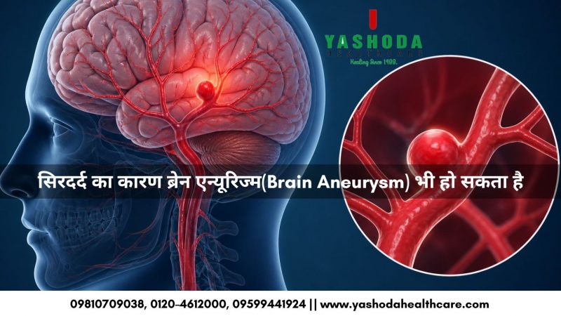 सिरदर्द का कारण ब्रेन एन्यूरिज्म(Brain Aneurysm) भी हो सकता है