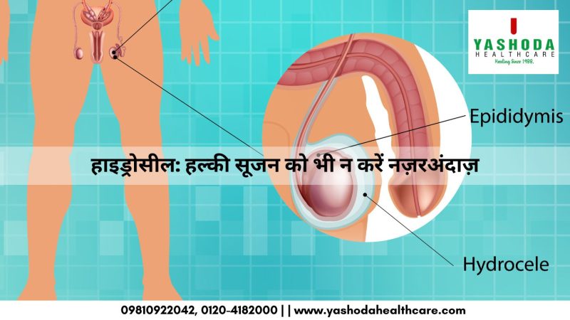 हाइड्रोसील हल्की सूजन को भी न करें नज़रअंदाज़