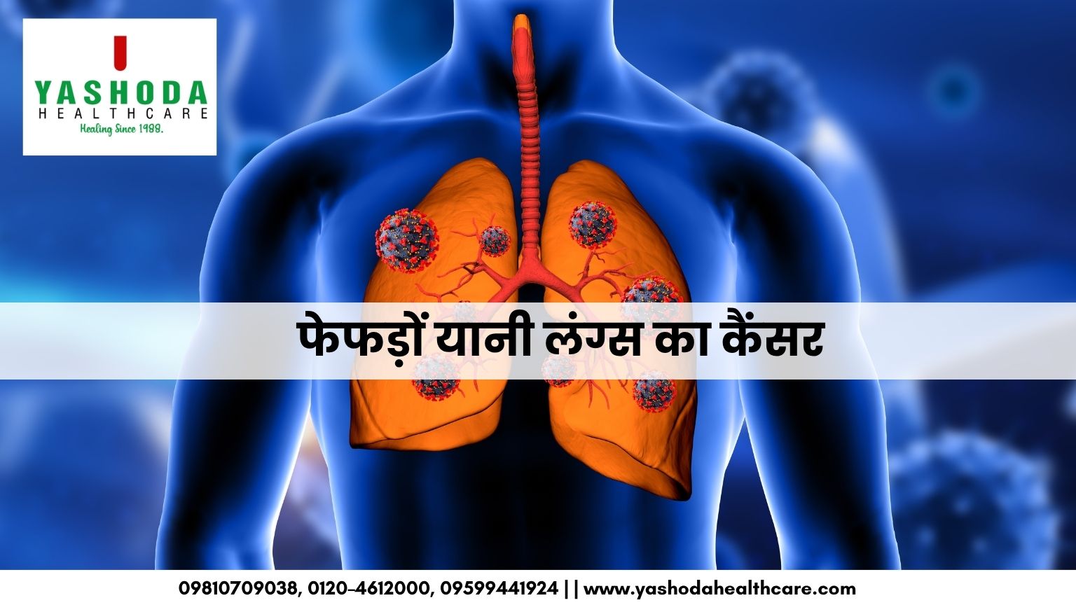 फेफड़ों यानी लंग्स का कैंसर: कारण, लक्षण, जांच, उपचार और इसके बचाव