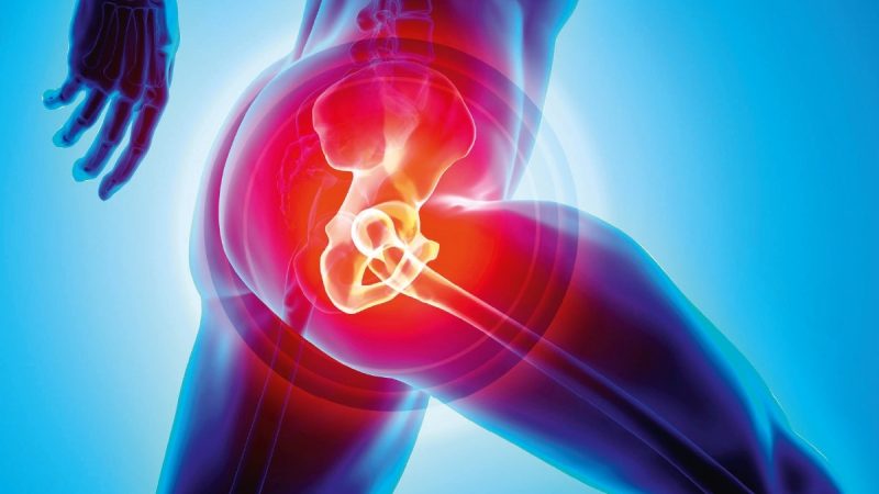 Best Doctor For Hip Replacement Surgery In Ghaziabad