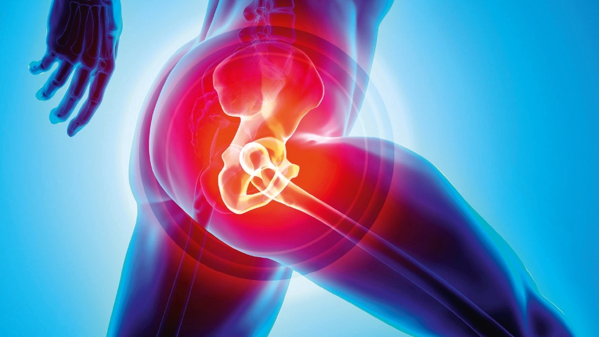 What To Expect After A Hip Replacement Surgery Yashoda Hospital