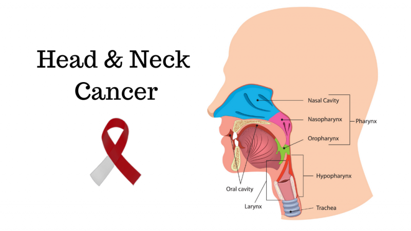 Head And Neck Cancer Treatment