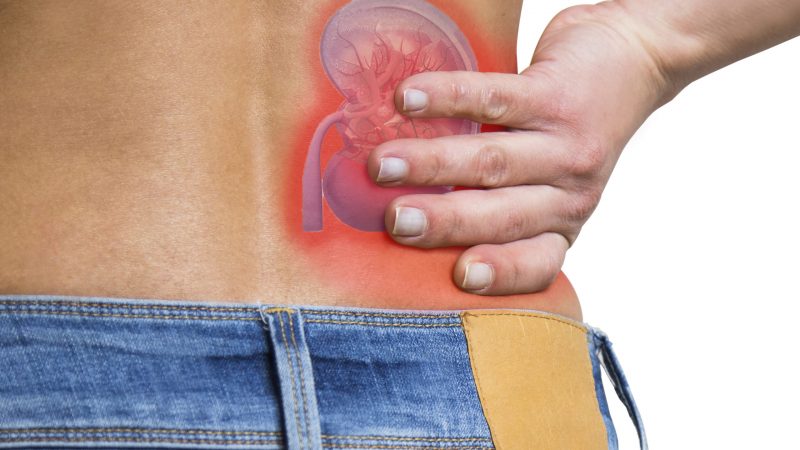 Treatment For Kidney Stones