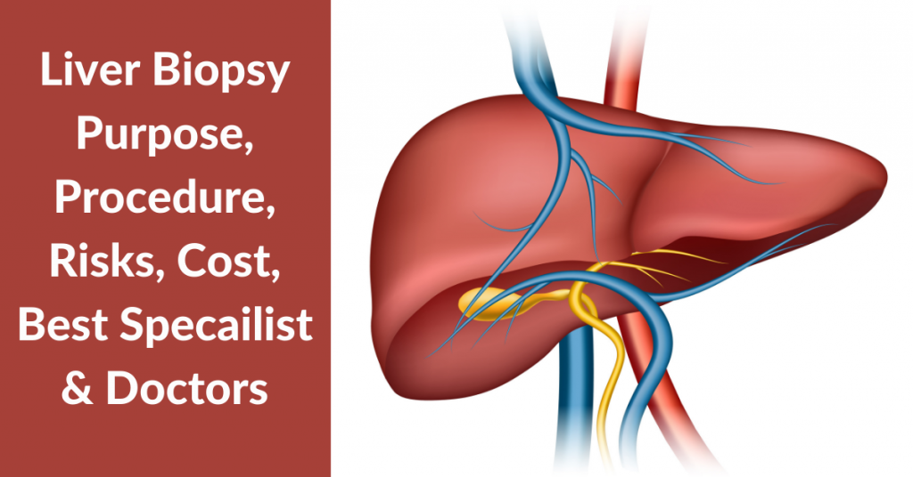 Liver Biopsy Cost Purpose Procedure Yashoda Hospital
