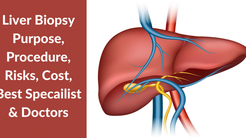 liver biopsy test cost in Ghaziabad