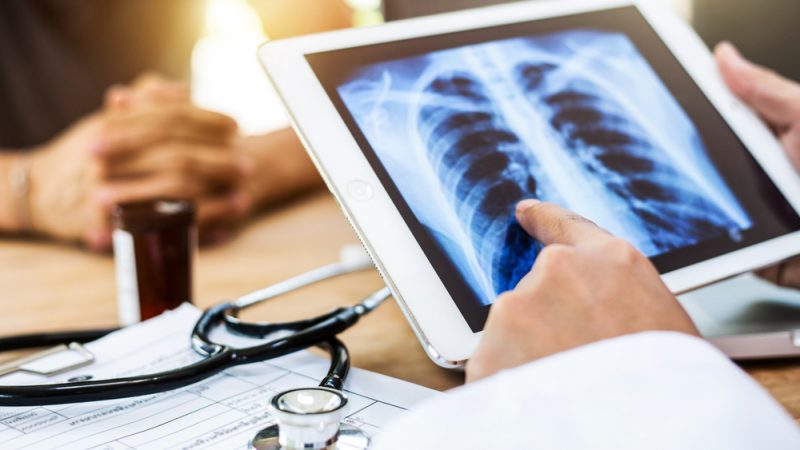 Thorax & Lung Cancer Symptoms