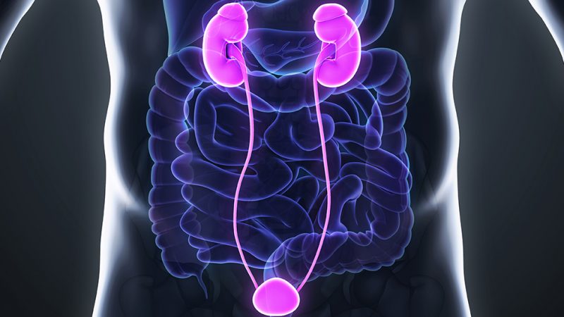 Best Doctors For Ureteral Stones Treatment In Delhi Ncr