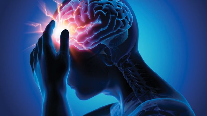 Stroke (Brain Attack): Types, Causes, Signs, Symptoms