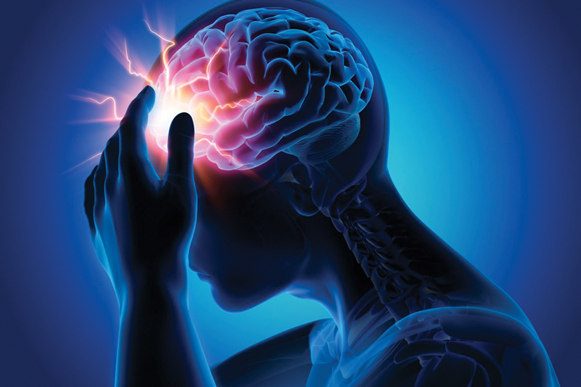 Stroke (Brain Attack): Types, Causes, Signs, Symptoms, Risk factors,  Diagnosis, Best Doctor or Hospitals for Stroke (Brain Attack) Treatment In  Delhi NCR & Ghaziabad - Yashoda Hospital