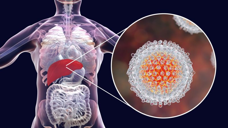 Best Hospital or Doctors for Hepatitis C Treatment in Ghaziabad