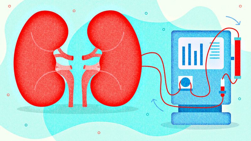 Best Kidney Dialysis Center in Ghaziabad or Delhi NCR