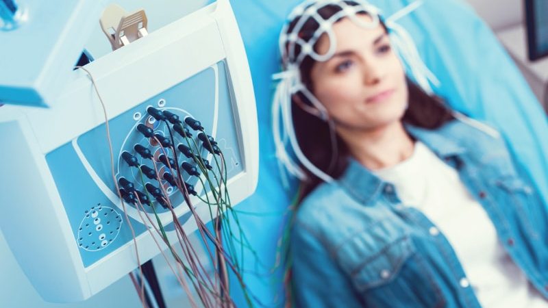 Video EEG Test price