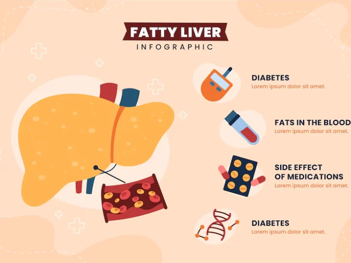 Fatty Liver Disease