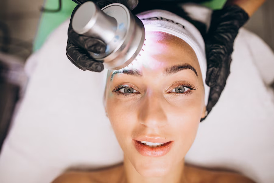 Laser Carbon Peel