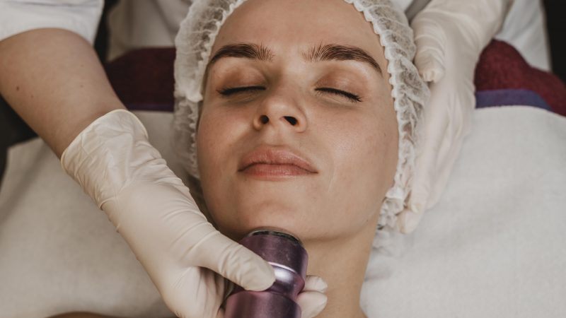 Laser Treatment
