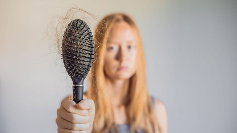 Everything You Need to Know About Hair Loss for 2024