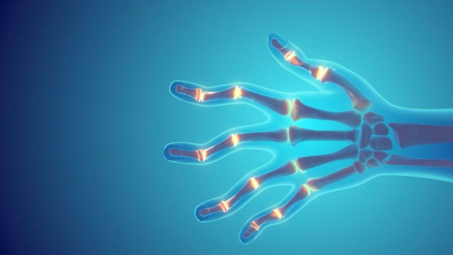 All About Rheumatoid Arthritis Symptoms, Risk Factors & Treatment