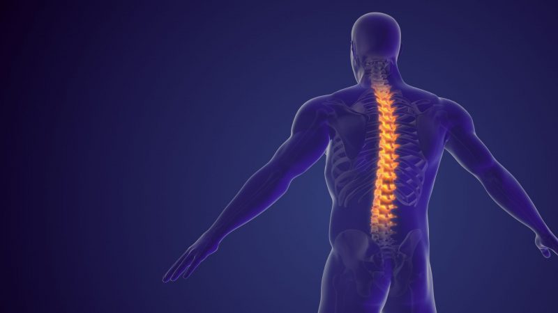 Spinal Fusion Surgery