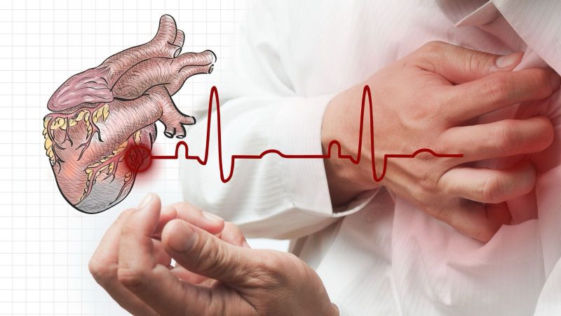 Heart Attack: Symptoms, Treatments & Precautions