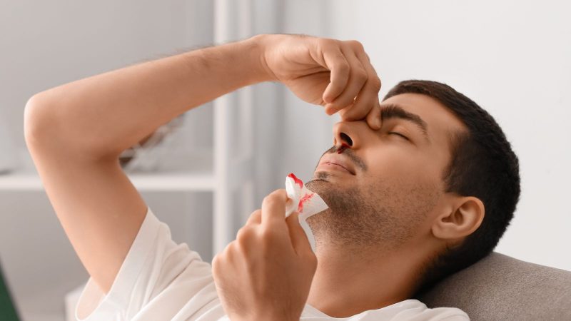 Nosebleeds: Causes, Procedure, Treatment & Prevention