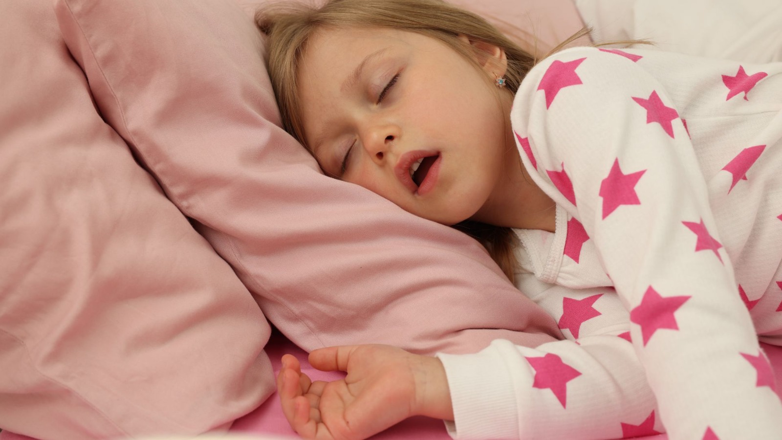 Sleep Disordered Breathing (SDB) in Children