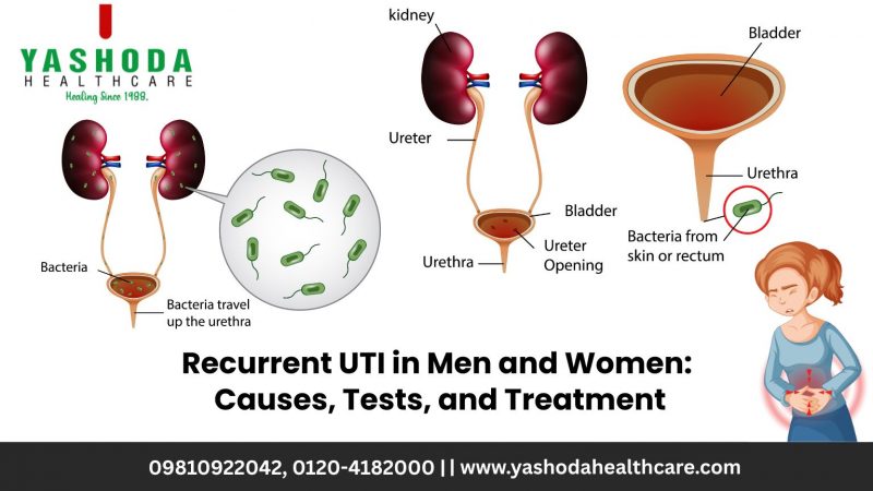 Recurrent UTI in Men and Women: Causes, Tests, and Treatment