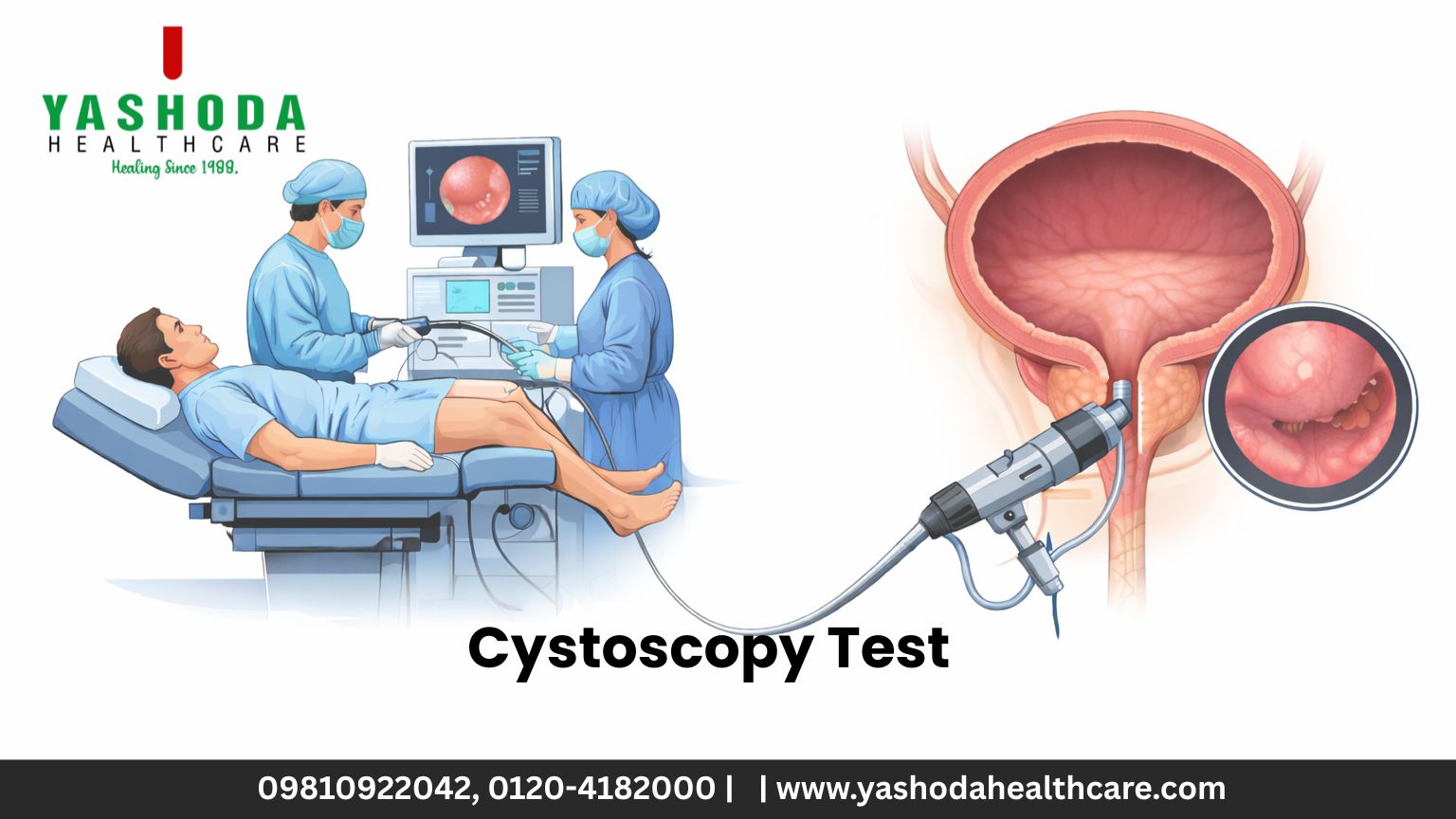 Cystoscopy Test: Why It Is Done and What to Expect