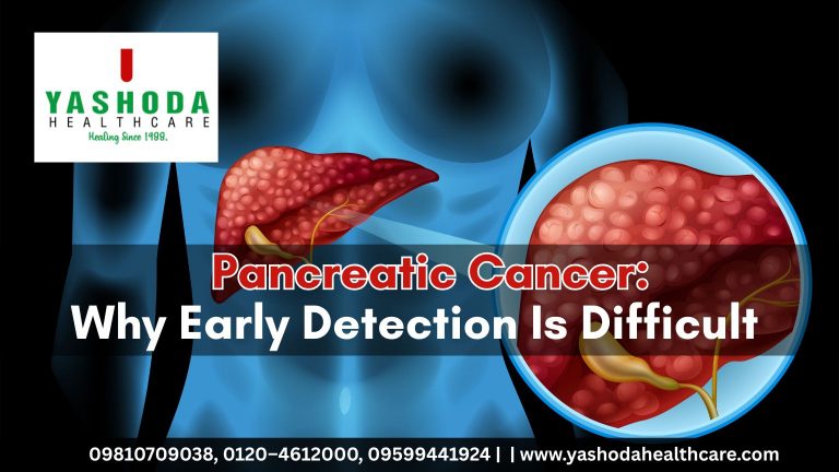 Why Pancreatic Cancer Is Hard to Detect Early | Symptoms & Risk Factors
