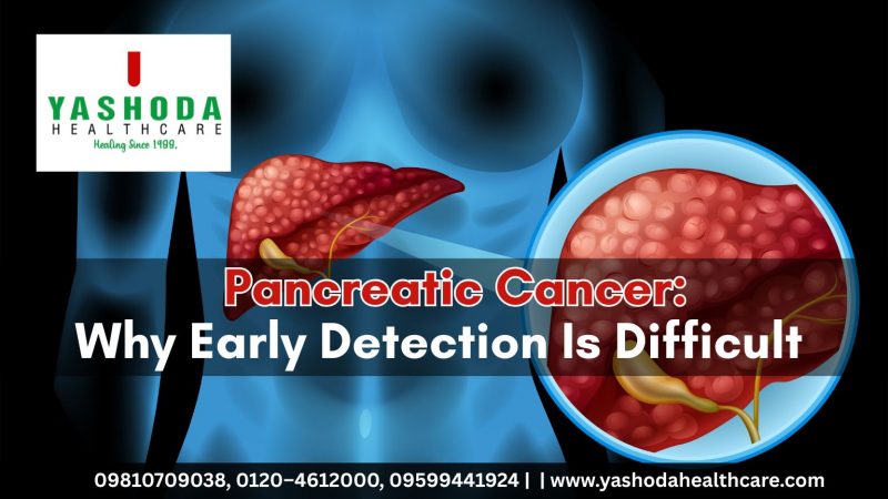 Pancreatic Cancer: Why Early Detection Is Difficult