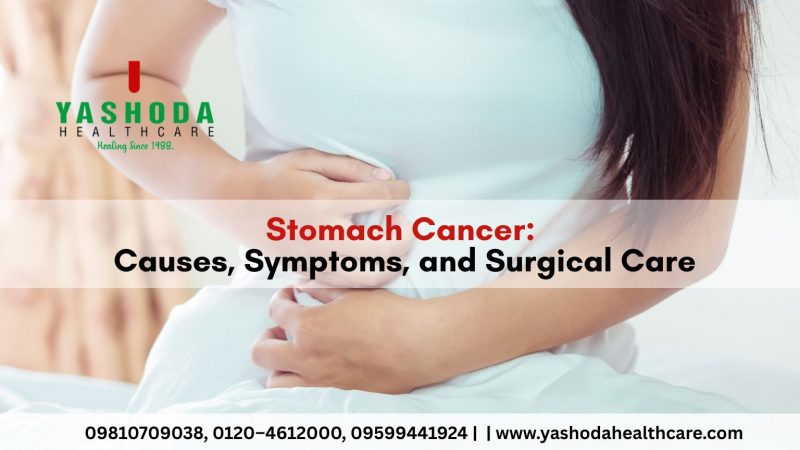 Stomach Cancer Causes, Symptoms, and Surgical Care
