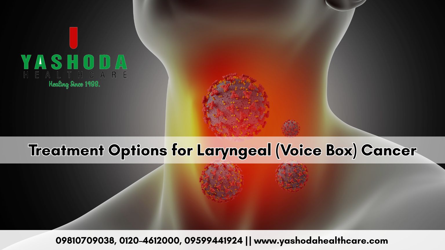 Treatment Options for Laryngeal (Voice Box) Cancer