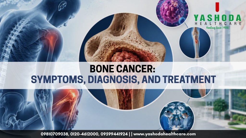 Bone Cancer: Types, Symptoms & Treatment - Yashoda Healthcare