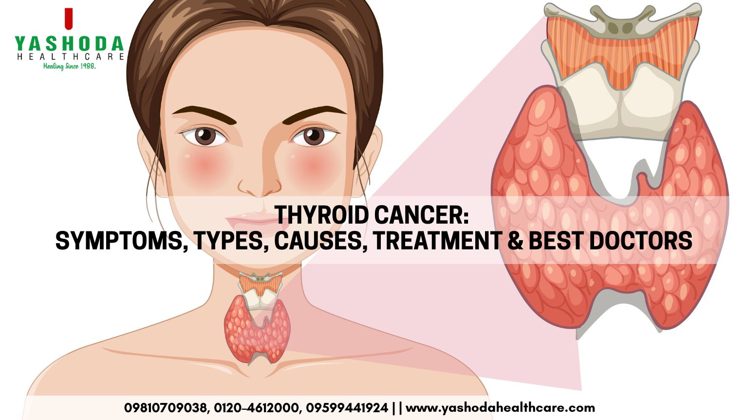 Thyroid Cancer: Symptoms, Types, Causes, Treatment Options & Best Doctors for Thyroid Cancer