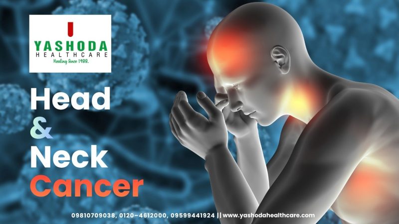 Head & Neck Cancer
